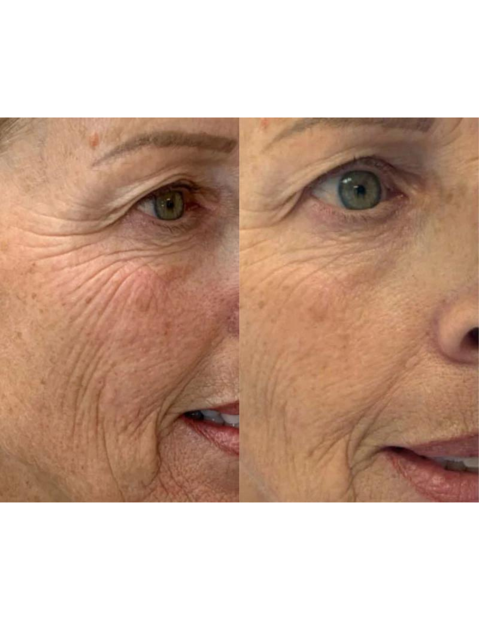 Gel régénérant anti-âge - Derma Collagen 60ml