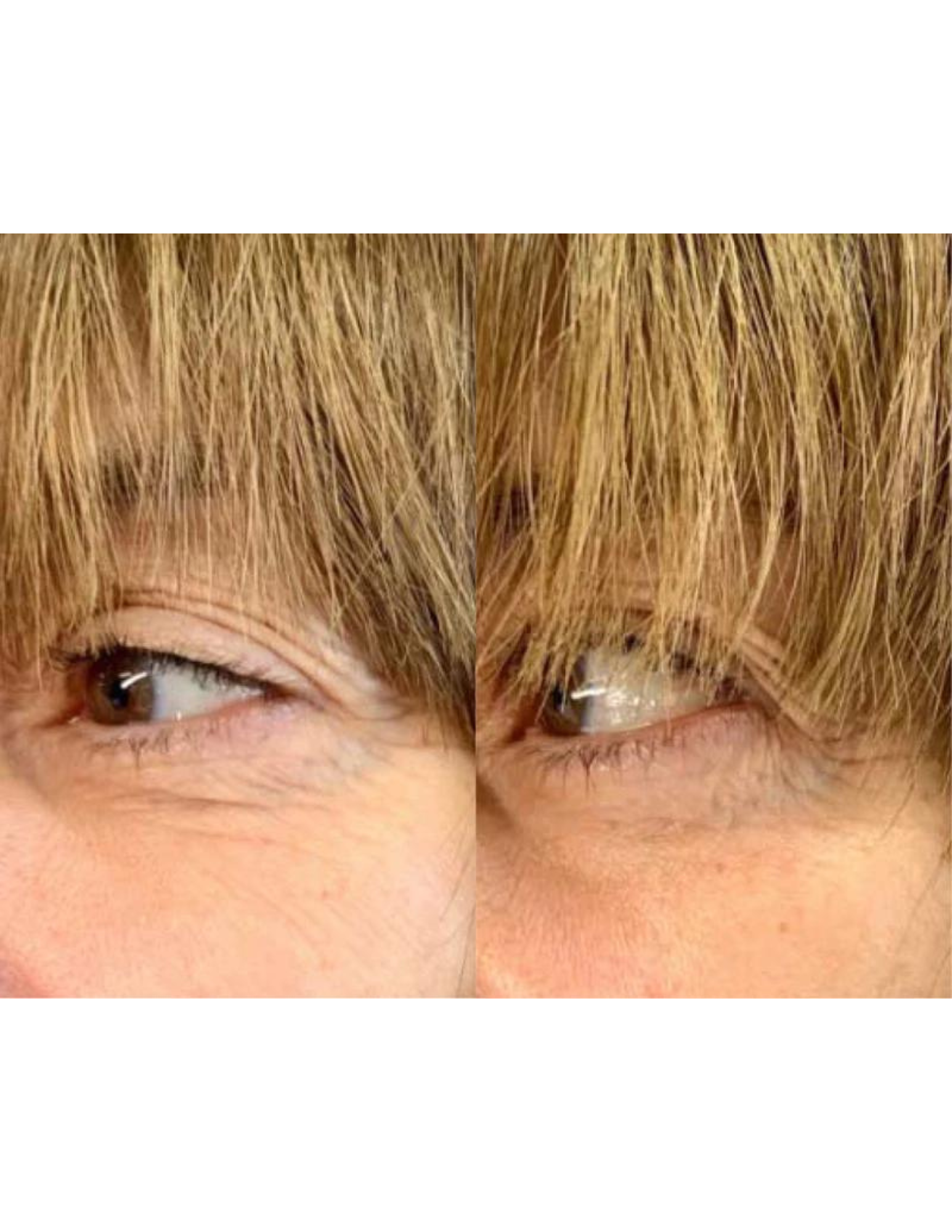 Regenerating anti-aging gel - Derma Collagen 60ml