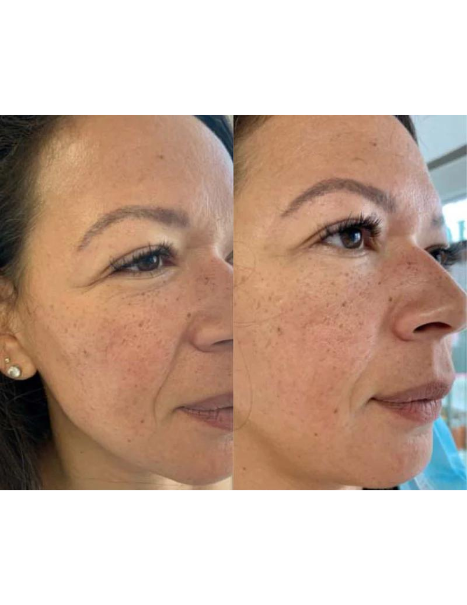 Regenerating anti-aging gel - Derma Collagen 60ml