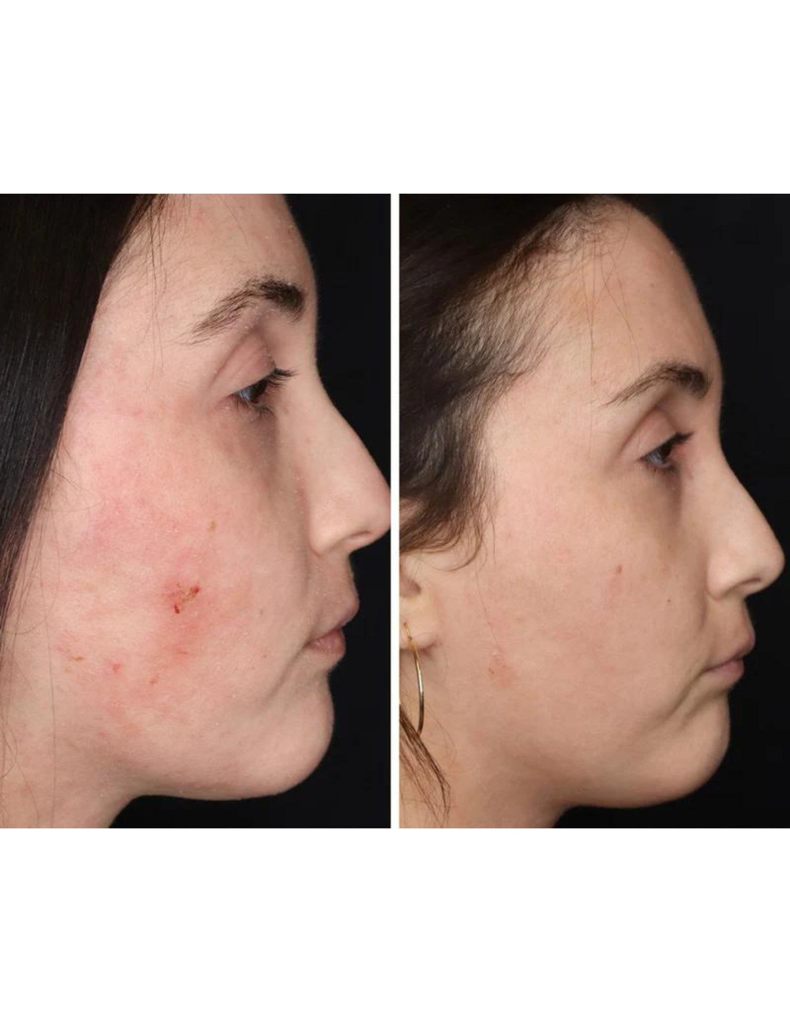 Regenerating anti-aging gel - Derma Collagen 60ml