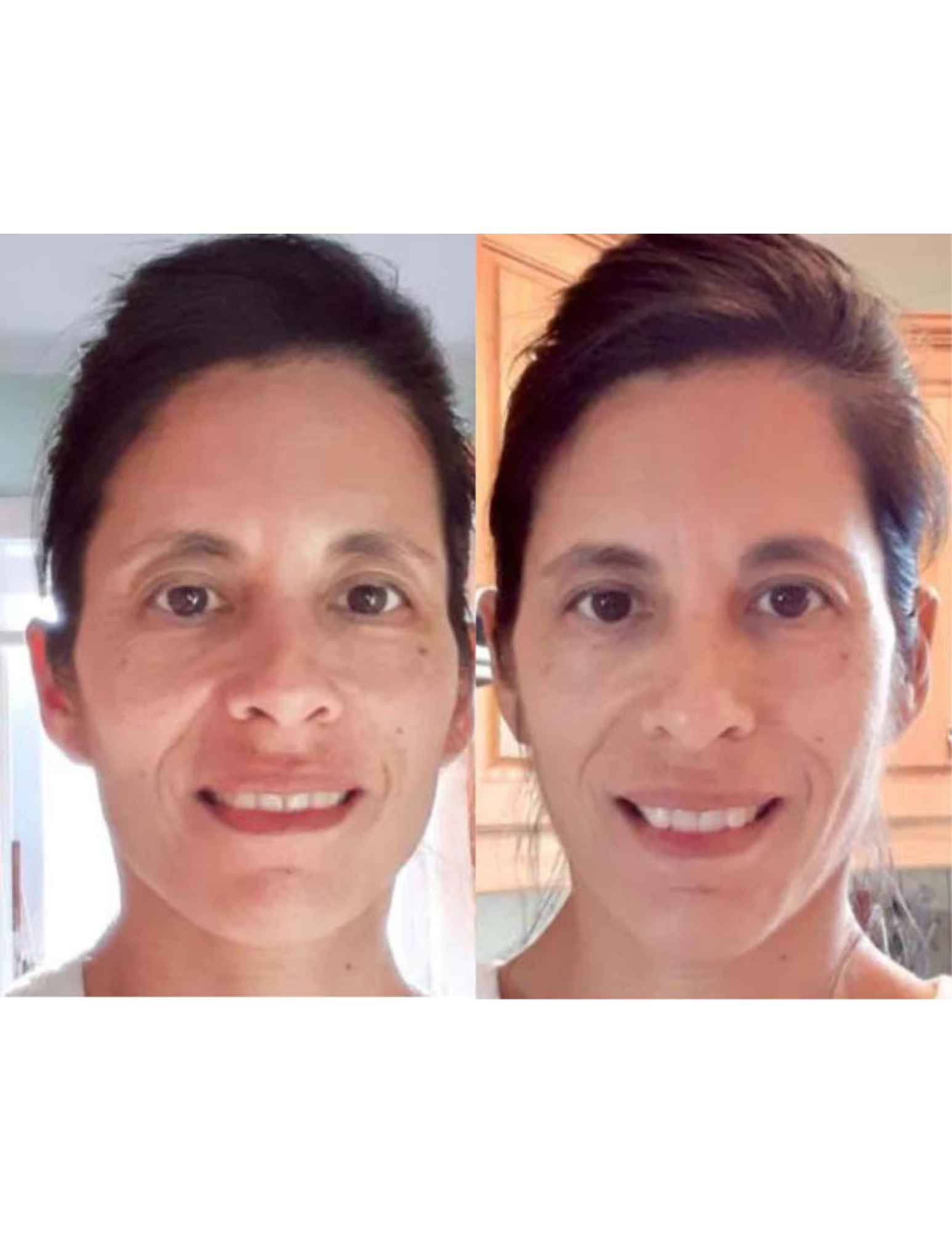 Duo RD Cosmetic - Large formats