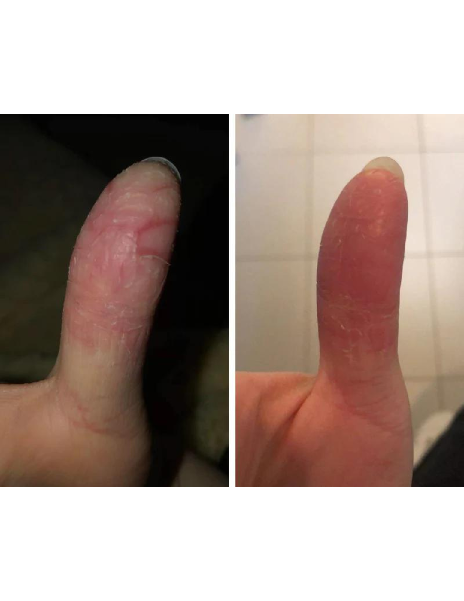 Gel raffermissant - Derma Elastin 156ml