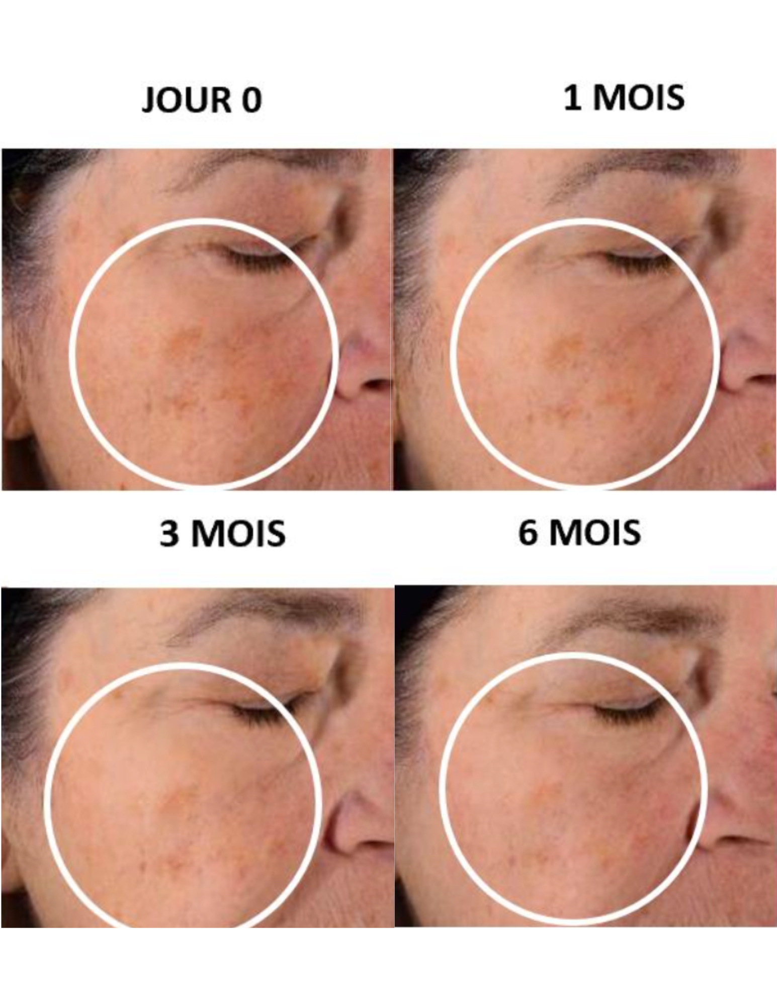 Coffret Noël Esthederm - Pureté
