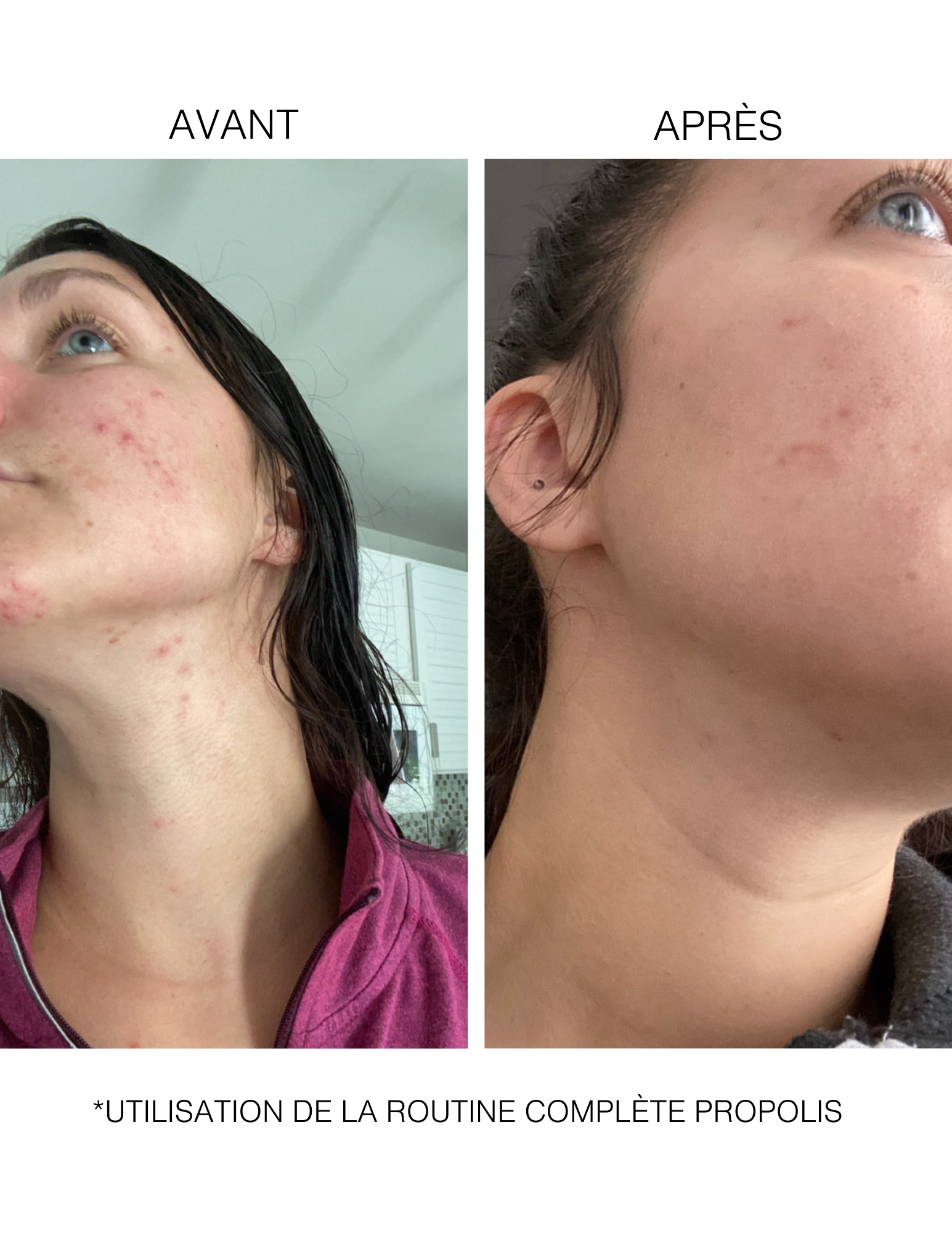 Intensive Propolis : Routine traitante pour peaux mixtes à grasses et irrégularités