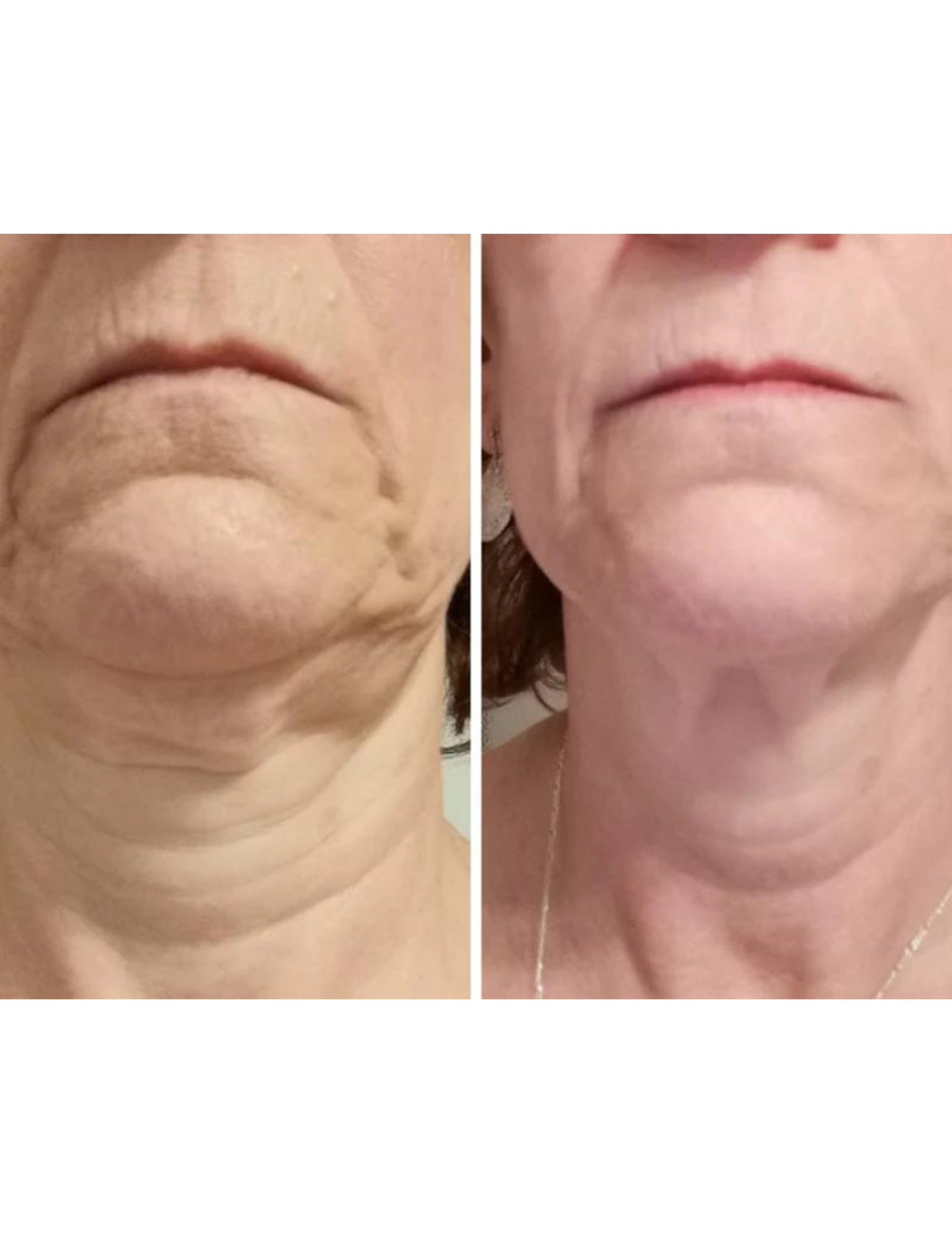 Regenerating anti-aging gel - Derma Collagen 60ml