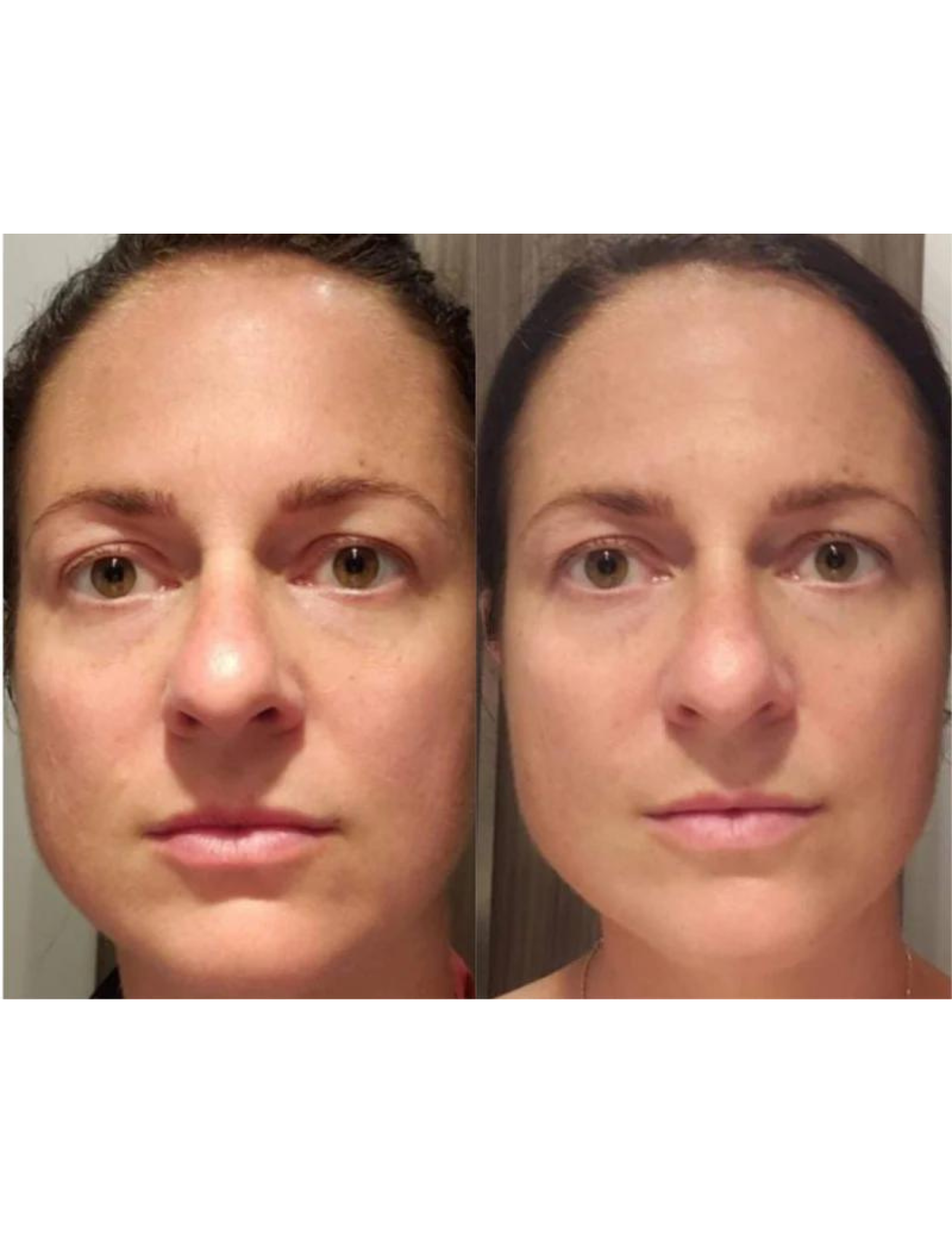 Regenerating anti-aging gel - Derma Collagen 60ml