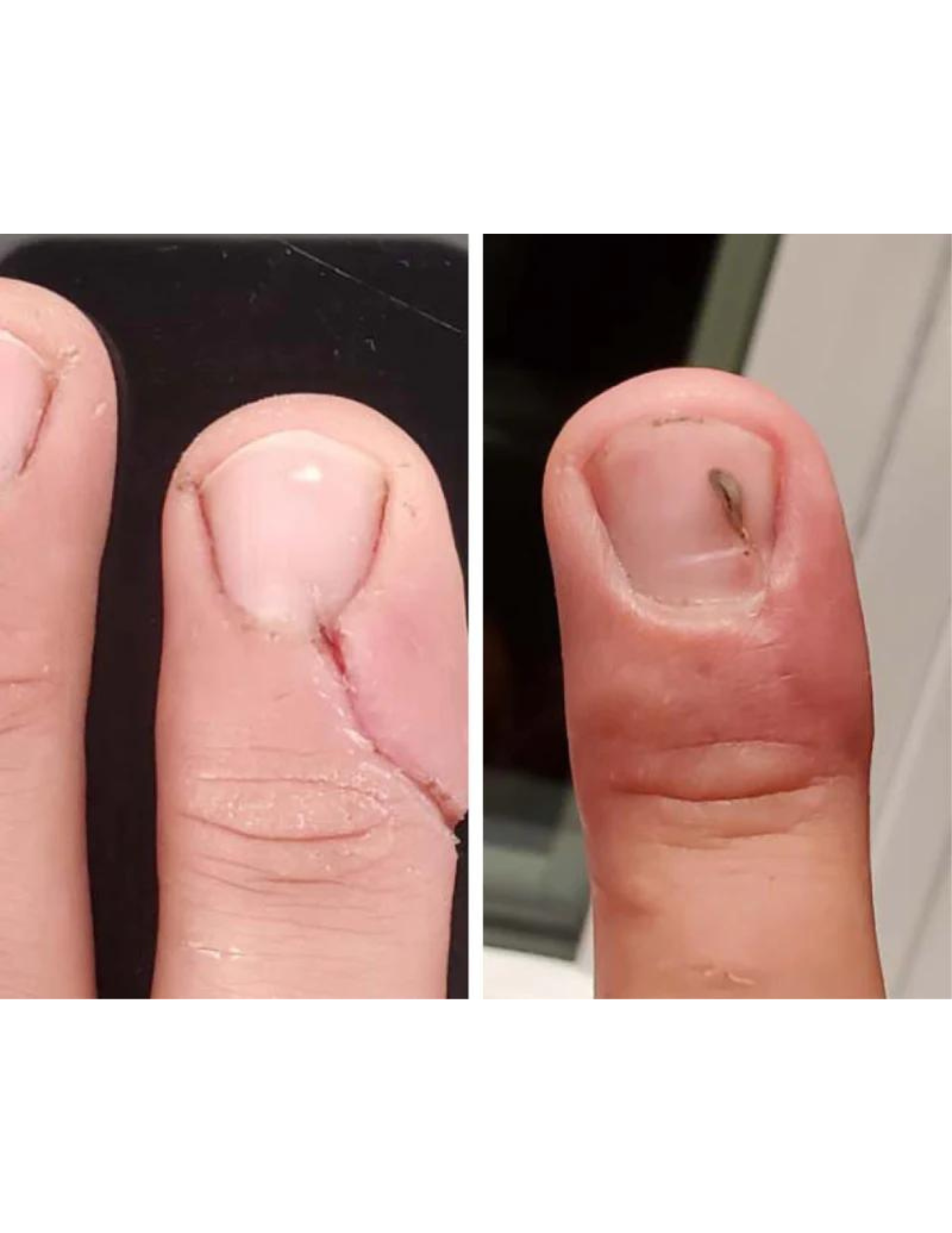 Gel raffermissant - Derma Elastin 60ml