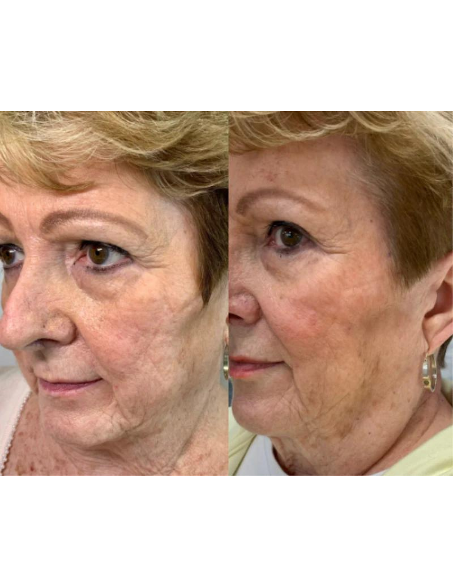 Regenerating anti-aging gel - Derma Collagen 60ml