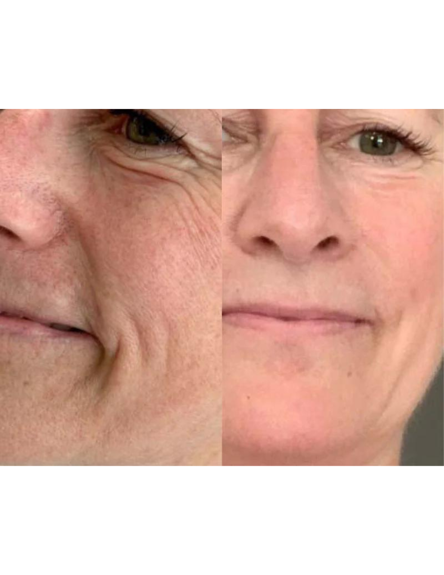 Gel régénérant anti-âge - Derma Collagen 60ml