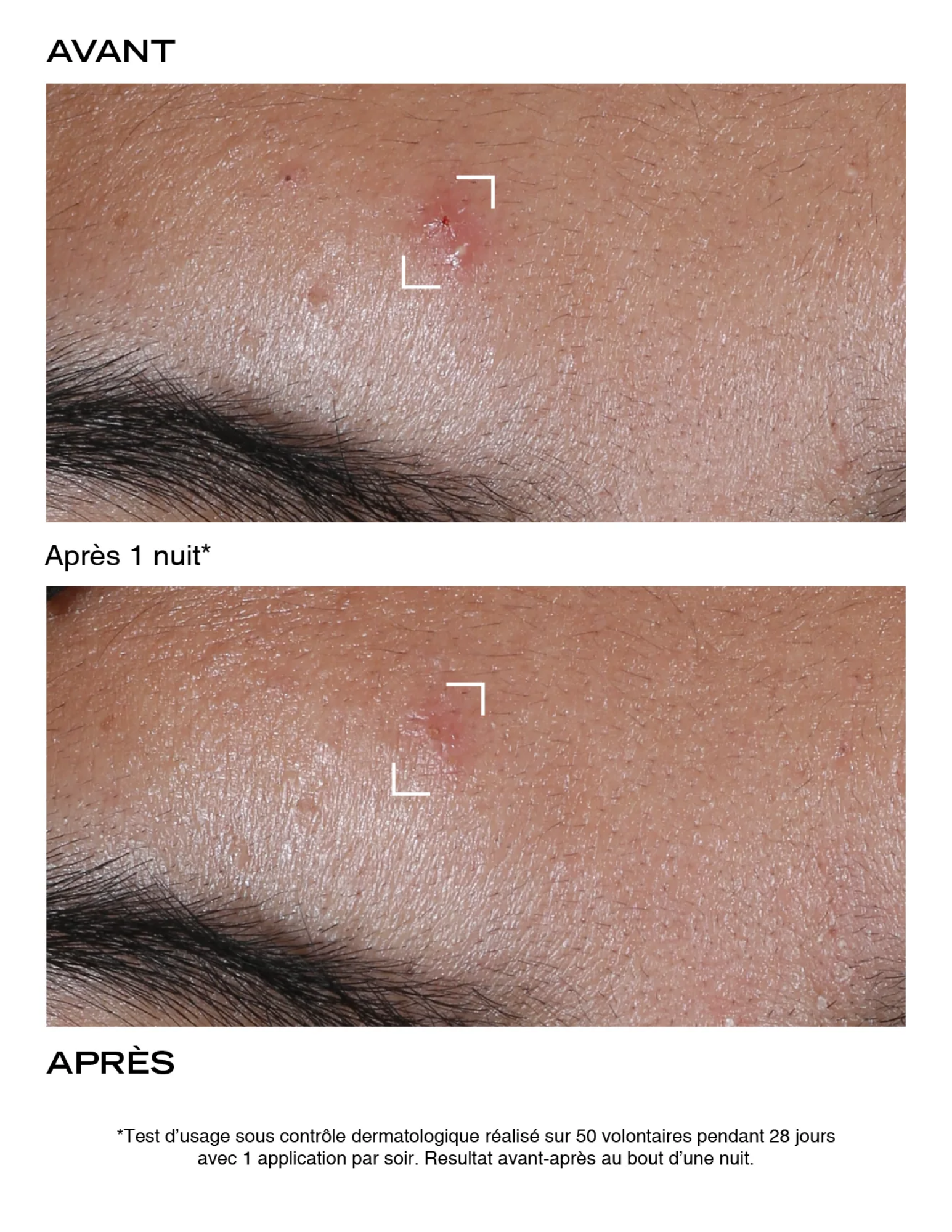 Pâte Originale Stop Bouton - Pâte Grise