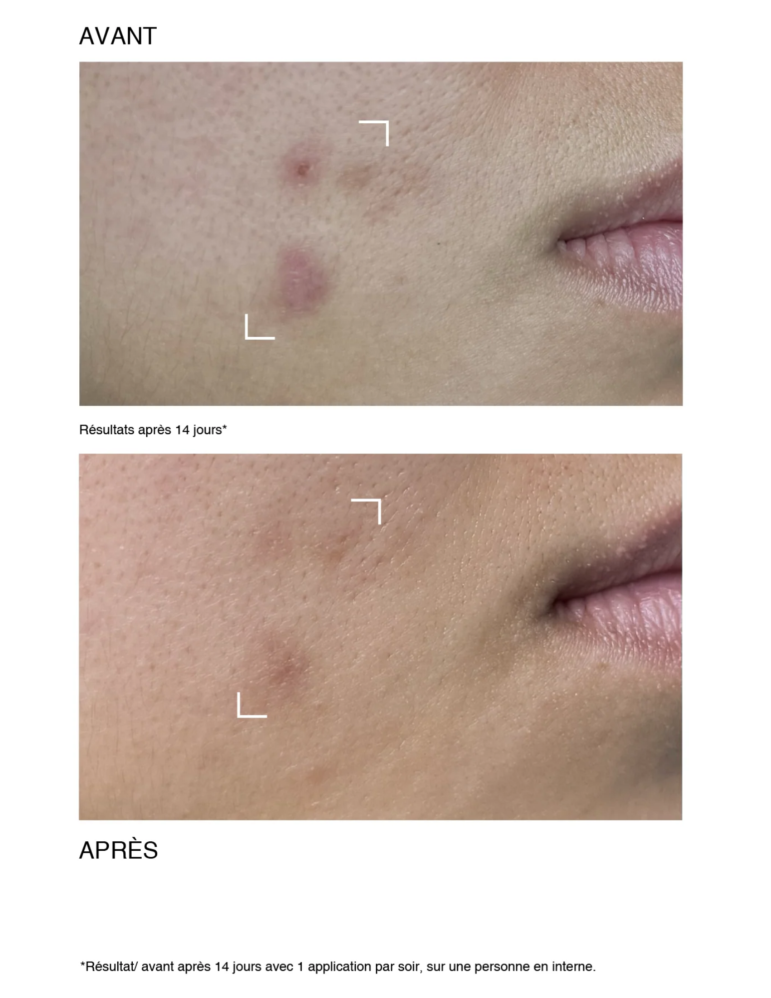 Sérum peeling rénovateur - Pâte Grise