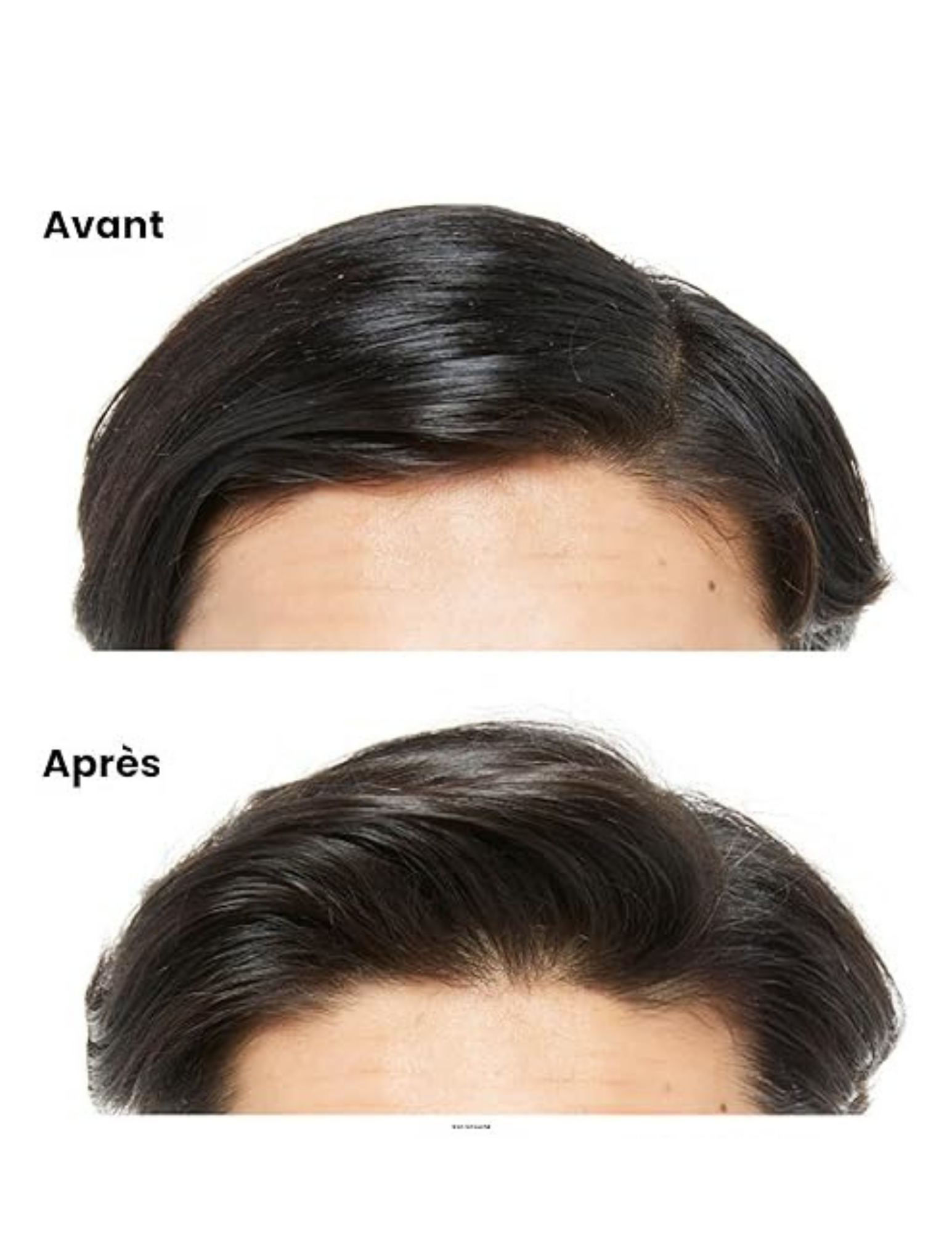 Derma-purifying anti-greasy shampoo 500ml - Scalp Advanced