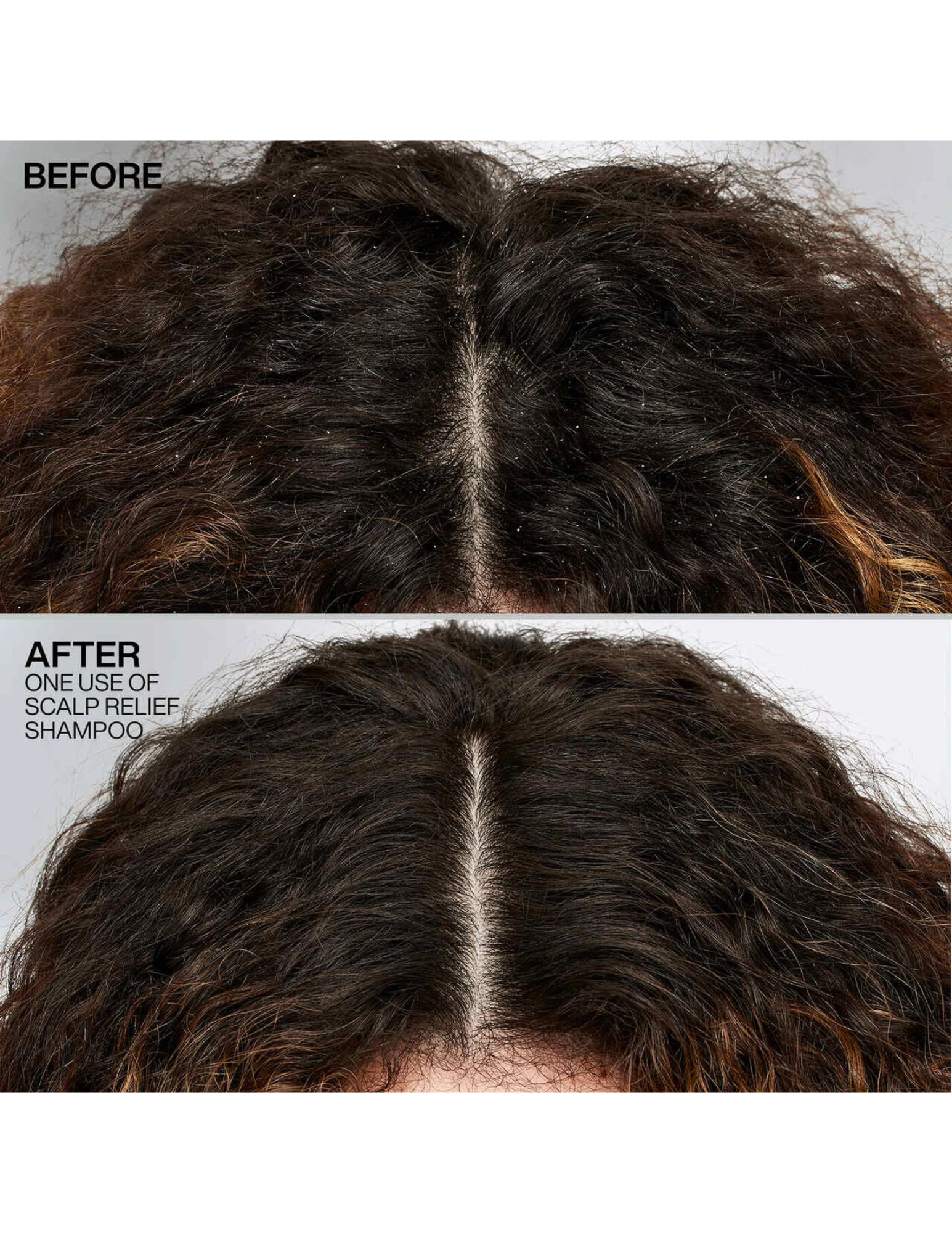 Shampoing anti-pelliculaire