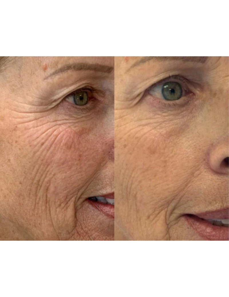 Gel régénérant anti-âge - Derma Collagen