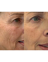Gel régénérant anti-âge - Derma Collagen 156ml