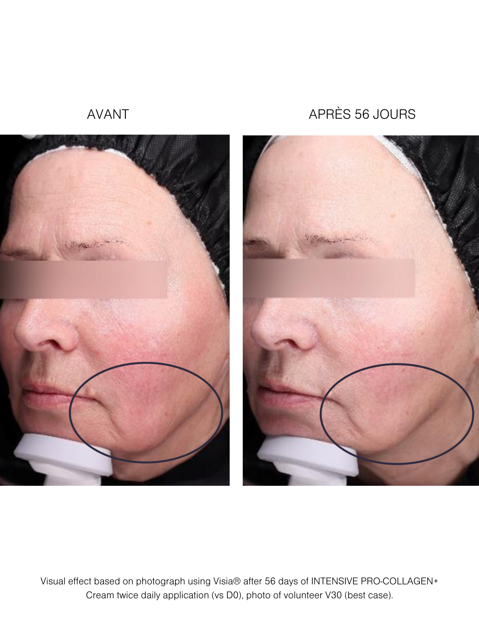 Routine Intensive Pro-Collagen+