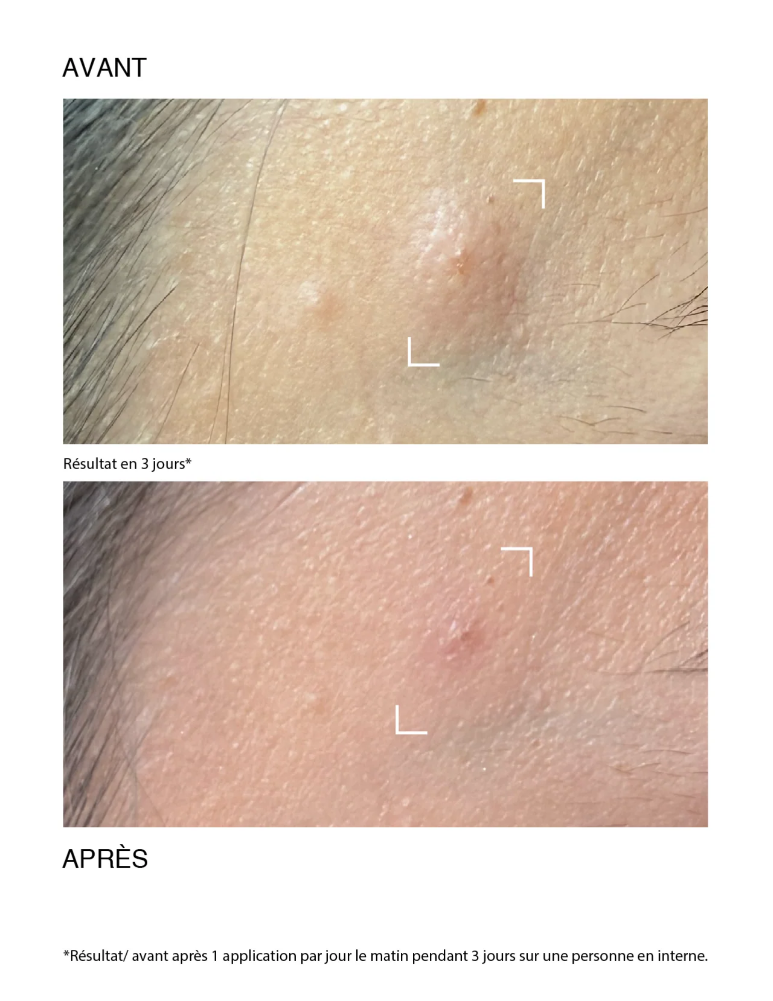 Speciale 5 Cica-Gel - Pâte Grise