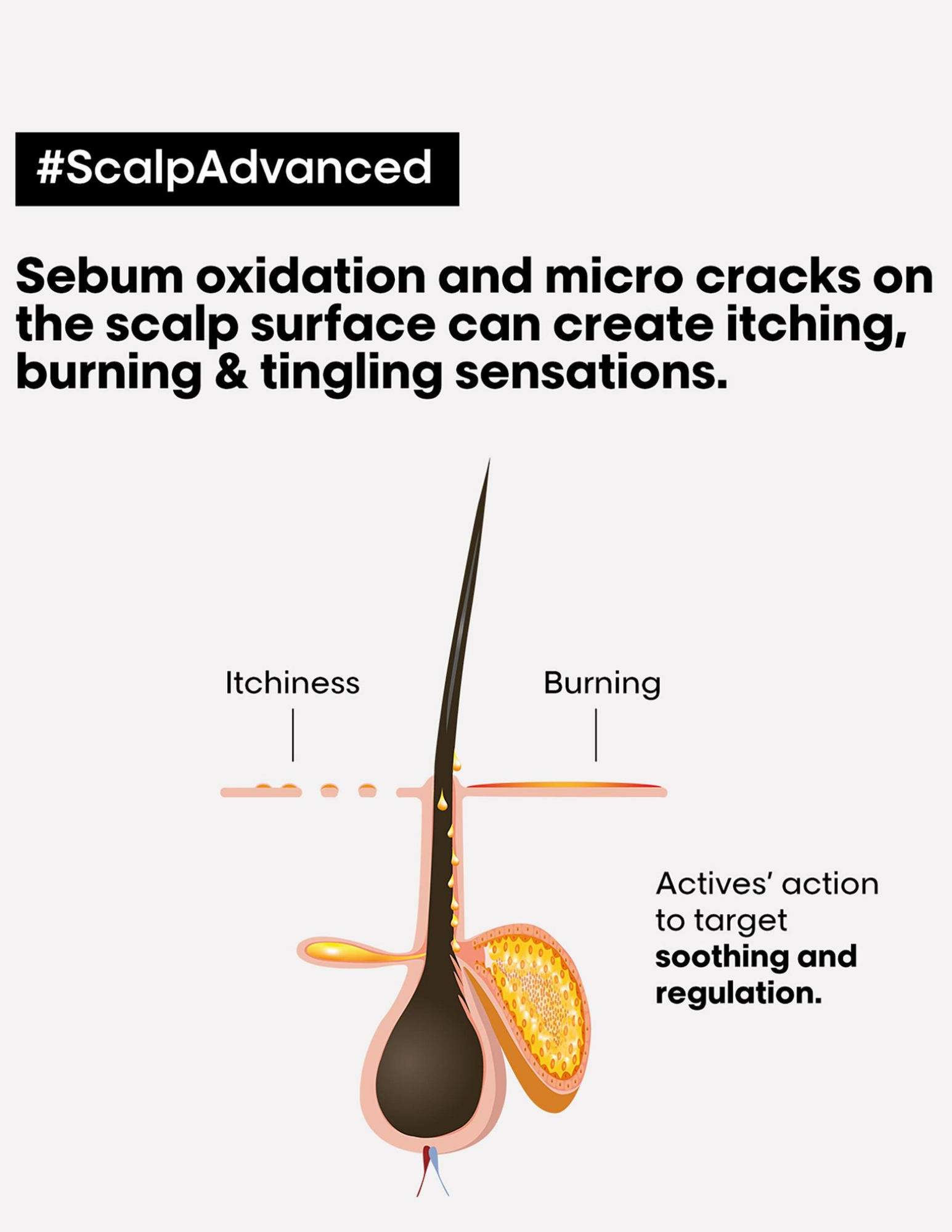 Intense anti-discomfort treatment - Scalp Advanced