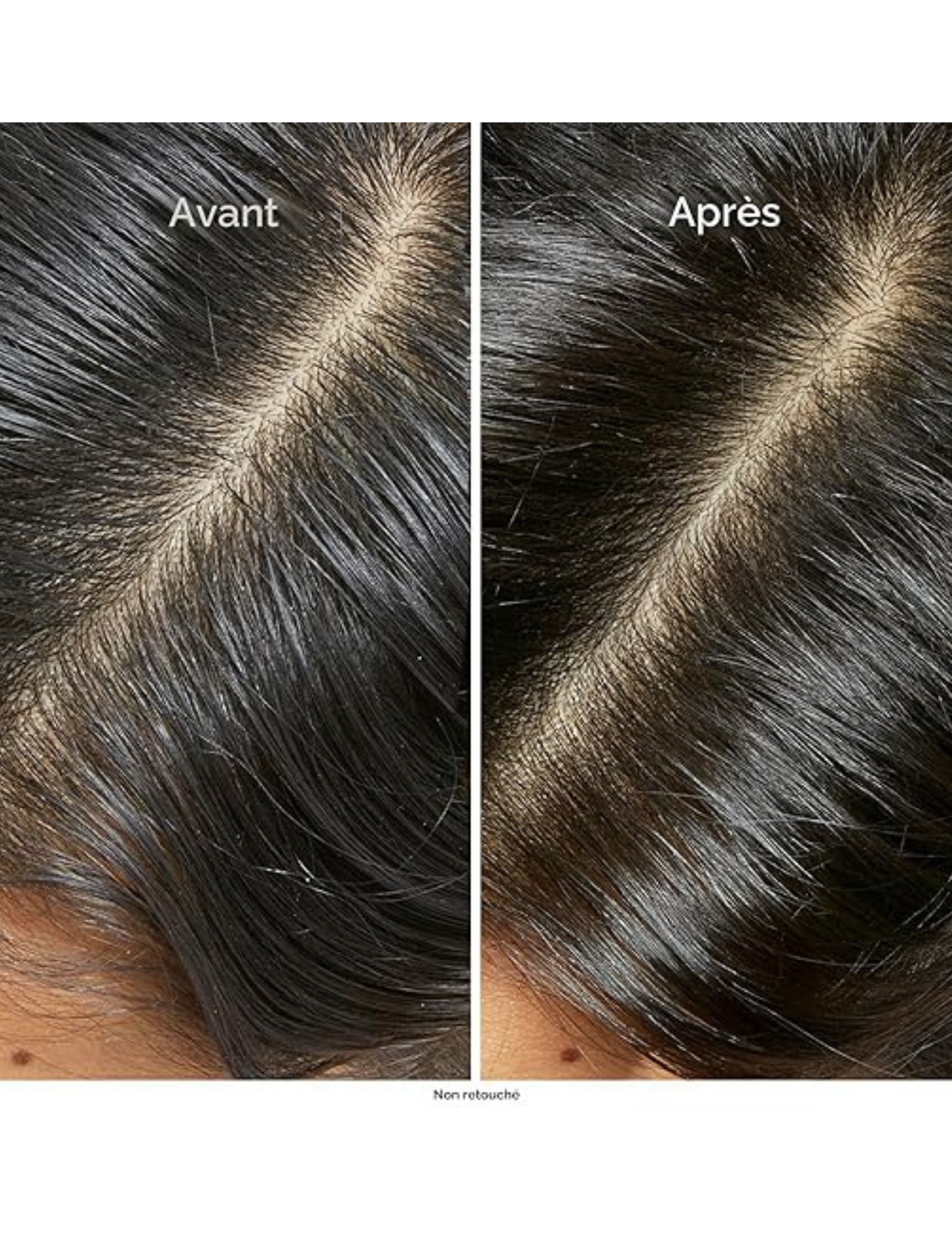 Derma-purifying anti-greasy shampoo 500ml - Scalp Advanced