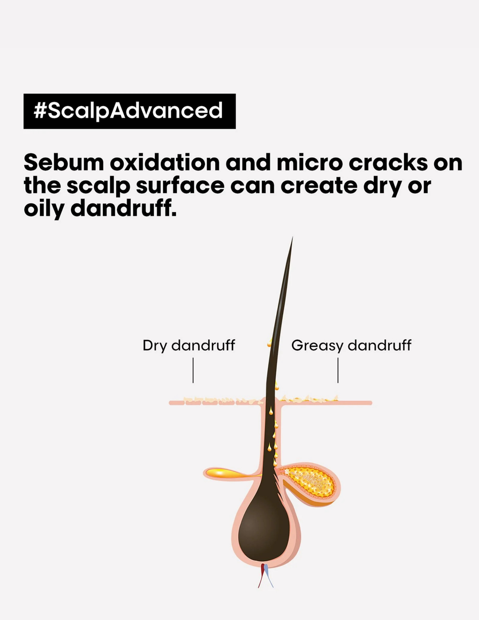 Anti-discomfort dermo-regulating shampoo 500ml - Scalp Advanced