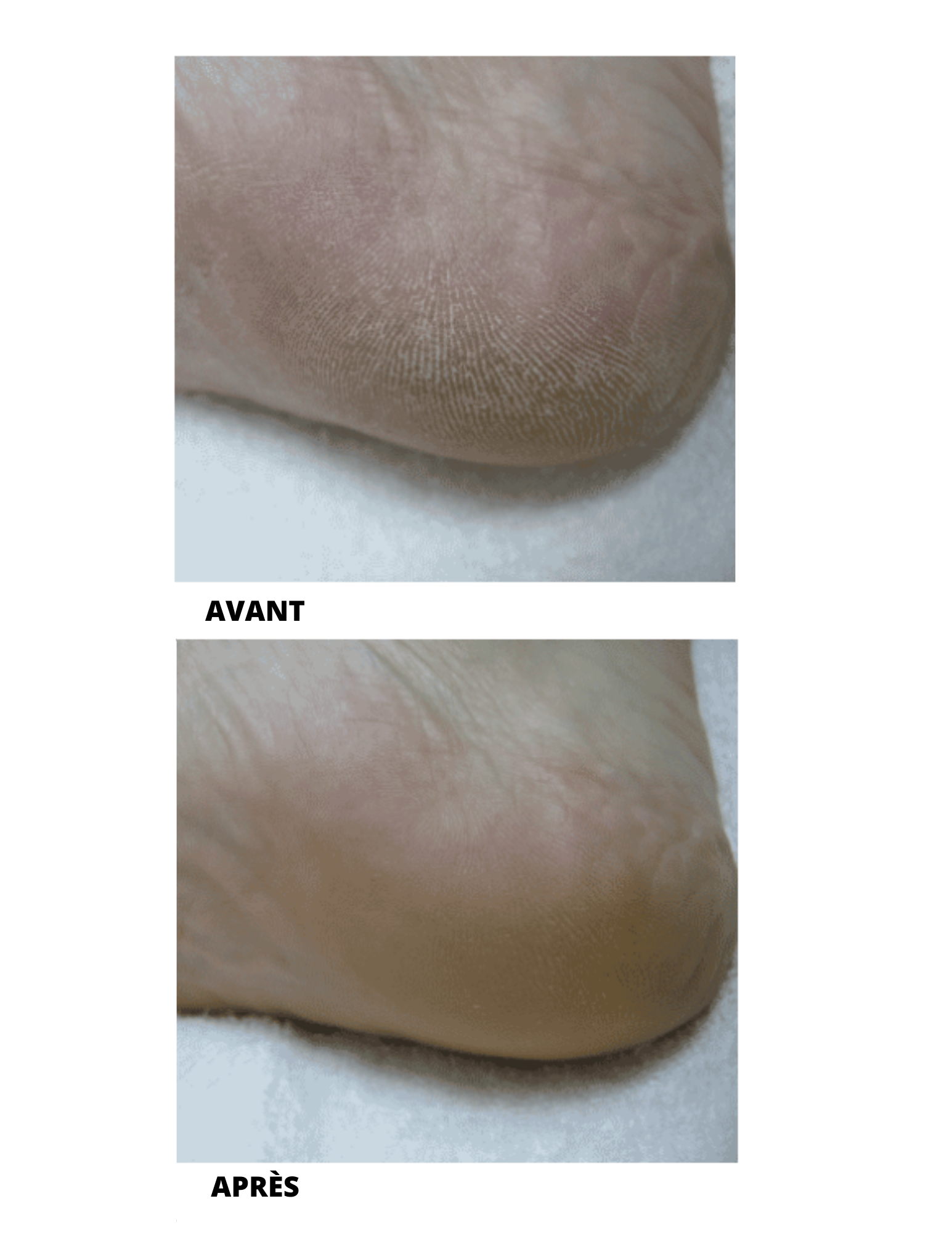 Mousse soins quotidiens